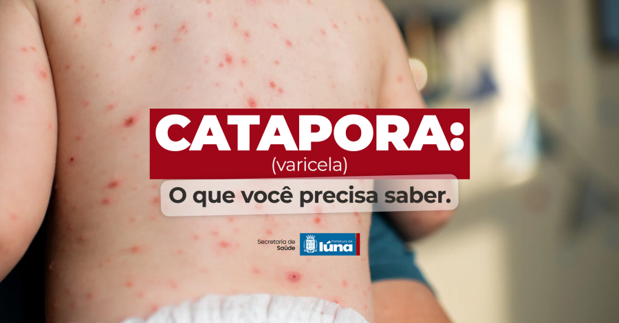Foto da Notícia